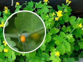 šťáva z celandinových bylin pro léčbu plantárních bradavic
